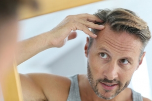 5 popularnych metod leczenia łysienia u mężczyzn — co warto wiedzieć?
